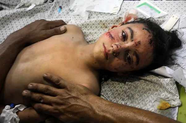 A Palestinian boy is treated at a hospital after an Israeli strike on his home in Rafah, in the southern part of the Gaza Strip. Ismael Mohamad/UPI/Shutterstock